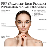 platelet rich plasma 